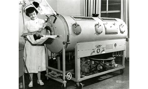 The Story of Artificial Ventilation .